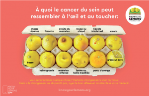 Symptomes du cancer du sein